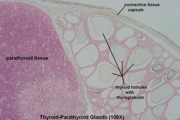 E-Thyroid- Parathyroid 100X 1