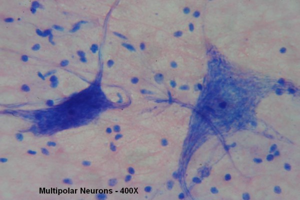 F – Multipolar Neurons 400X 3
