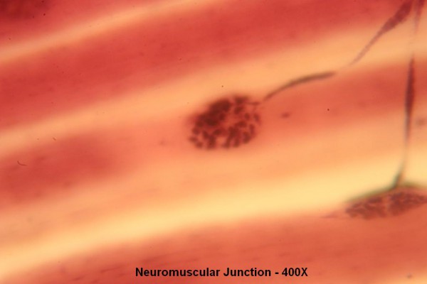 F – Neuromuscular Junction 400X 1
