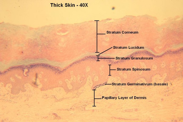 F – Thick Skin 40X 3 – Epidermal Layers