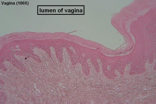 F Vagina 100x 2