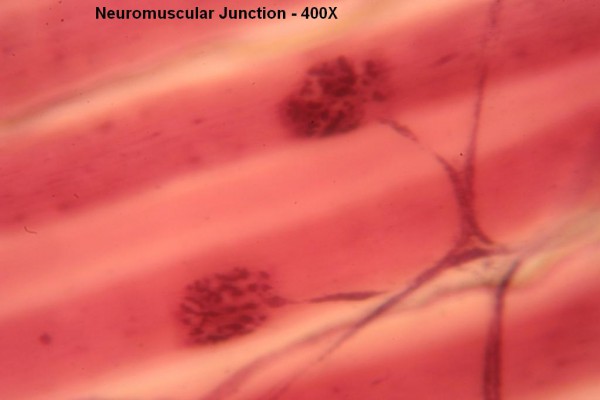 G – Neuromuscular Junction 400X 2