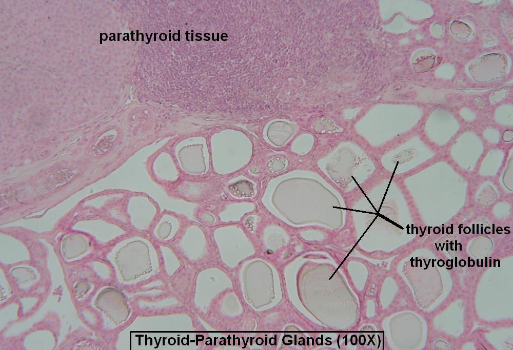 G-Thyroid- Parathyroid 100X 3