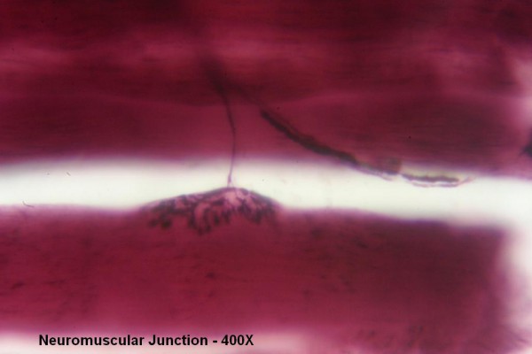 H – Neuromuscular Junction 400X 3