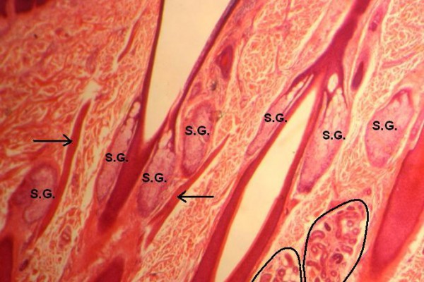 H Scalp 30x 7 Structures Within Dermis