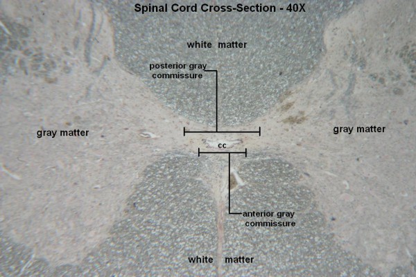 H – Spinal Cord X-Section 40X