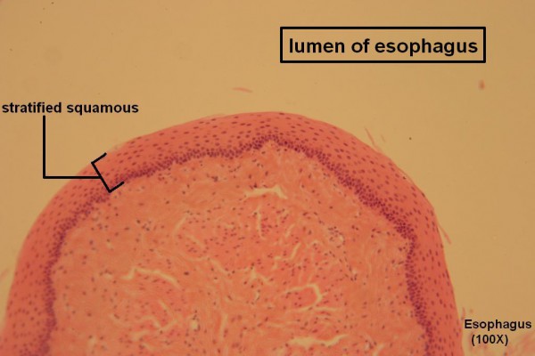 H Stratified Squamous 100x 6