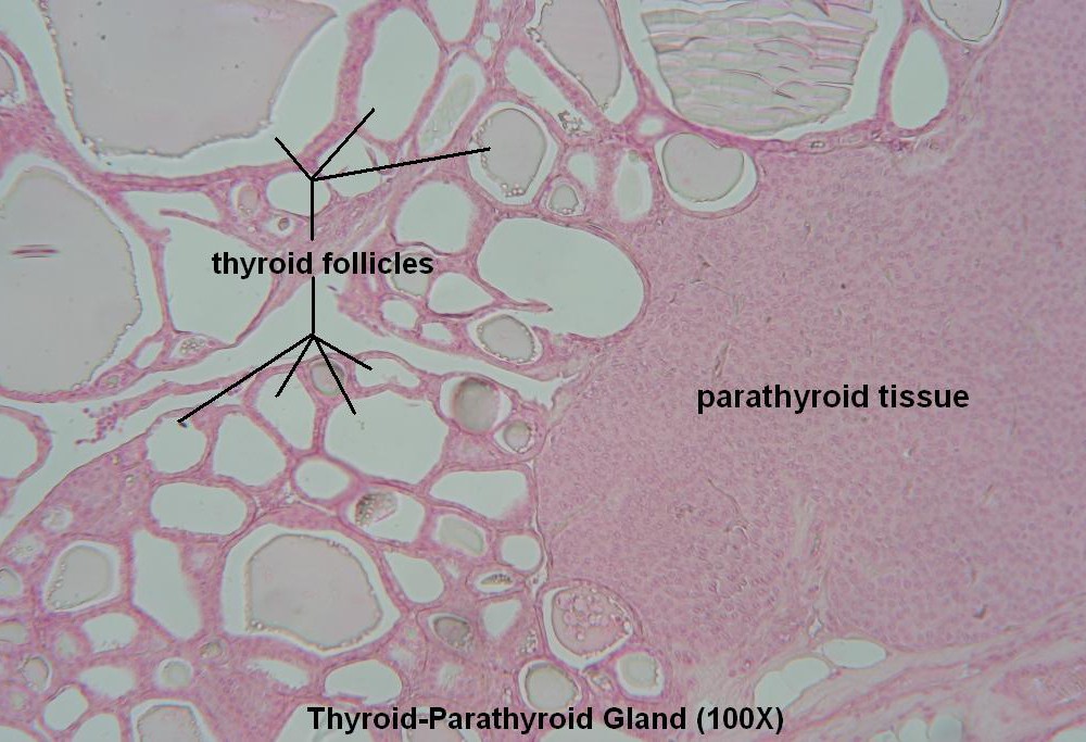 H-Thyroid- Parathyroid 100X 4