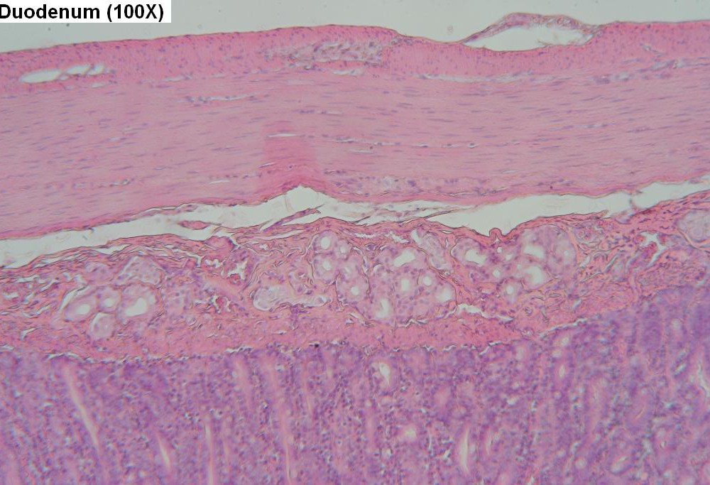 I – Duodenum Wall 100X 2