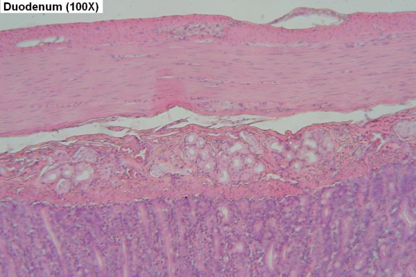 I – Duodenum Wall 100X 2