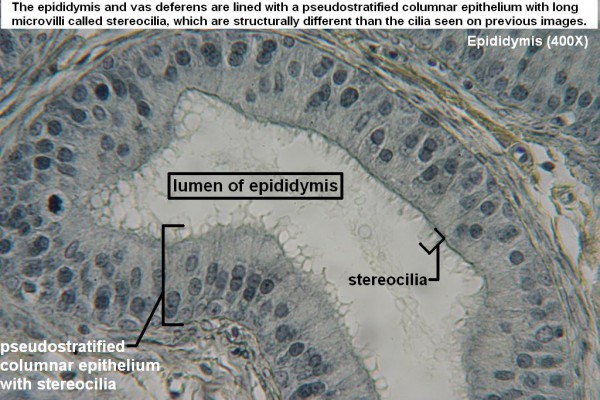 I  Pseudostratified Stereociliated Columnar 400X 1