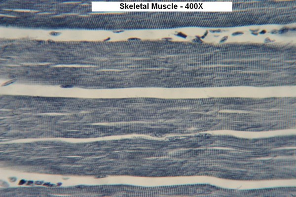 I Skeletal Muscle Long Section 400x 6