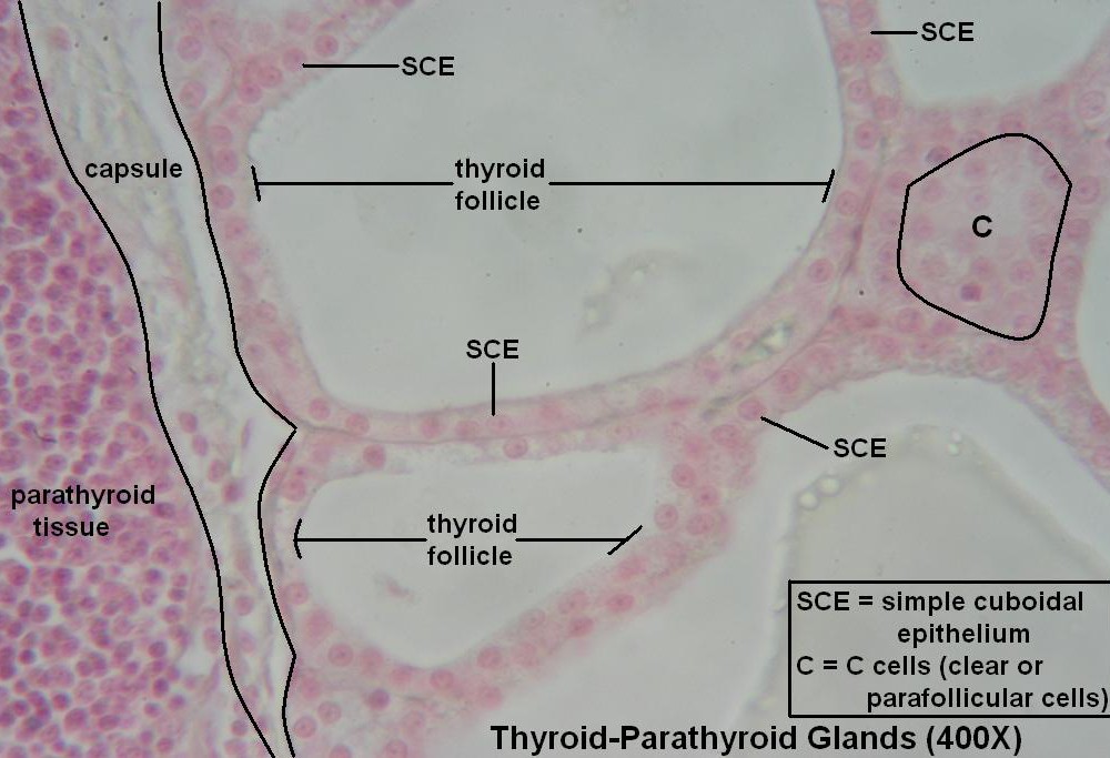 I-Thyroid- Parathyroid 400X 1