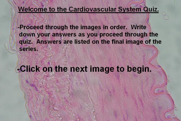 Image A Cardiovascular Quiz