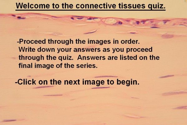 Image A – Connective Quiz