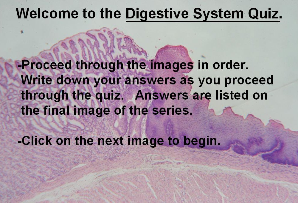 Image A – Digestive System Quiz