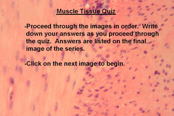 Image A Muscle Quiz