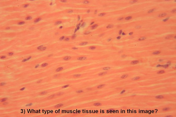 Image D Muscle Quiz