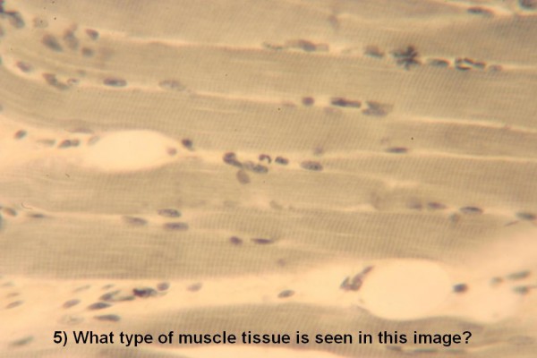 Image F Muscle Quiz