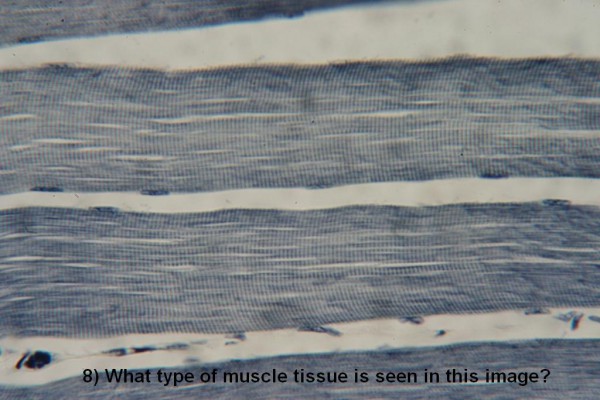 Image I Muscle Quiz