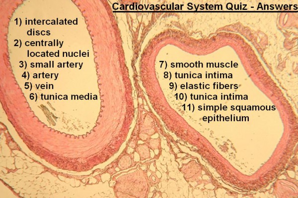 Image K Cardiovascular Quiz Answers