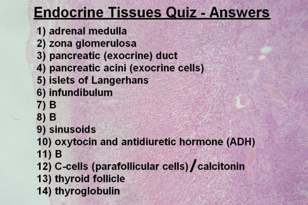 Image O – Endocrine Quiz Answers