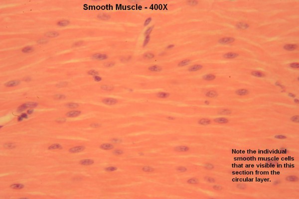 J – Smooth Muscle 400X 4