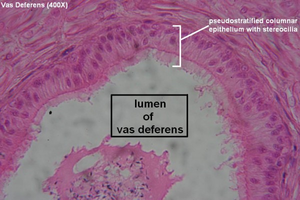 K  Pseudostratified Stereociliated Columnar 400X 3