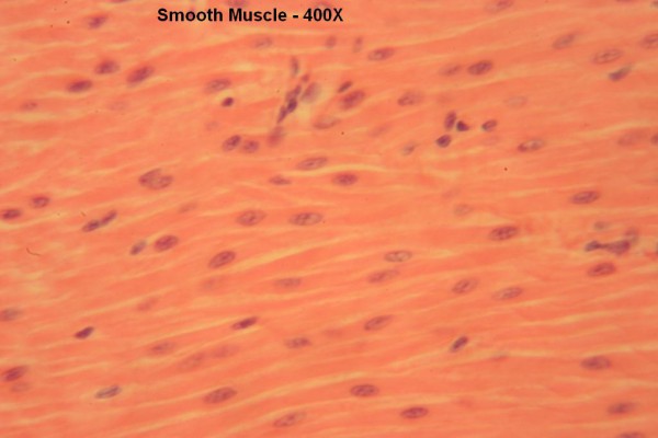 K Smooth Muscle 400x 5