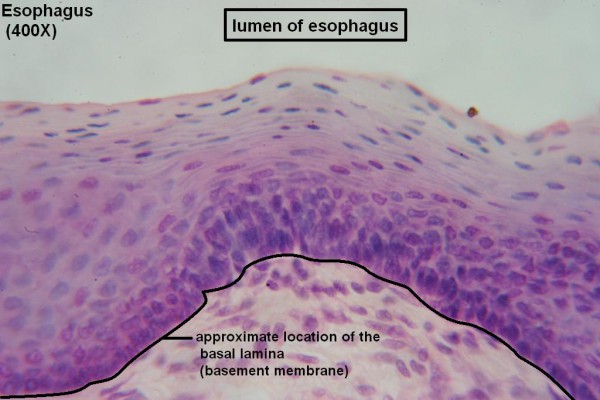 K Stratified Squamous 400x 1