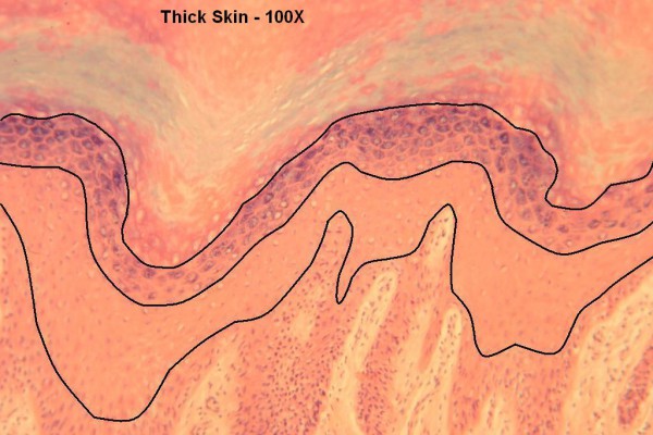 K – Thick Skin 100X 5 – Epidermal Layers