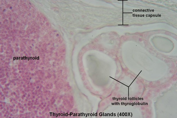 K-Thyroid- Parathyroid 400X 3