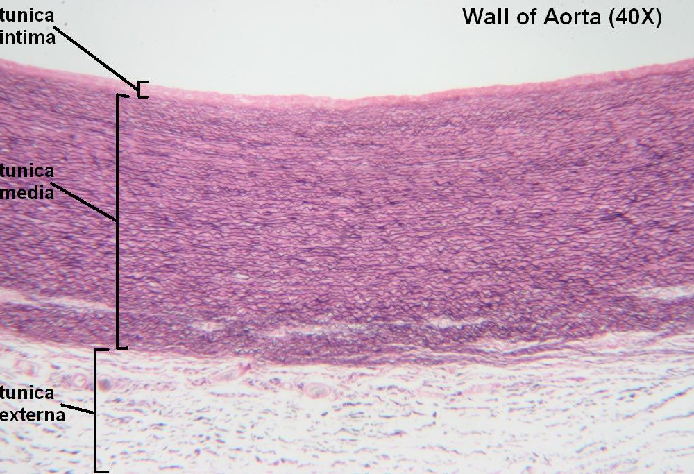 K Wall of Aorta 40X 1
