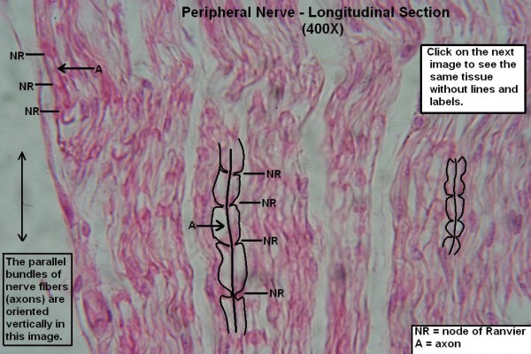 L – Peripheral Nerve – Long Section – Node of Ranvier 400X 1