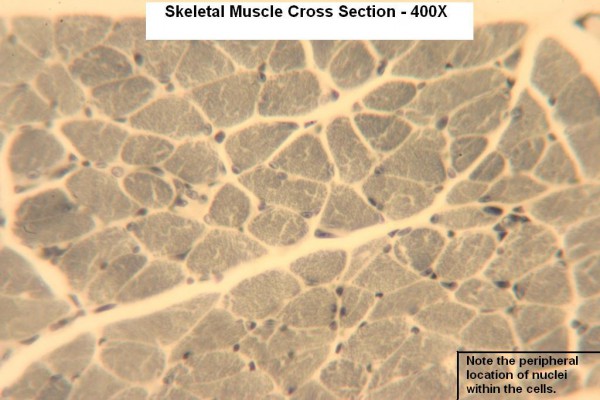 L Skeletal Muscle Section X Section 400x 1