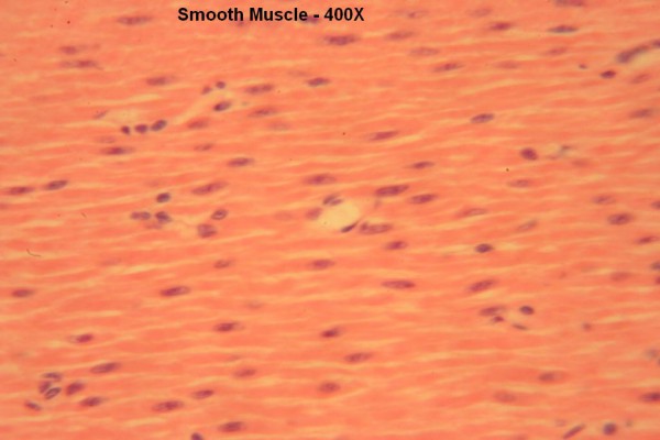 L Smooth Muscle 400x 6