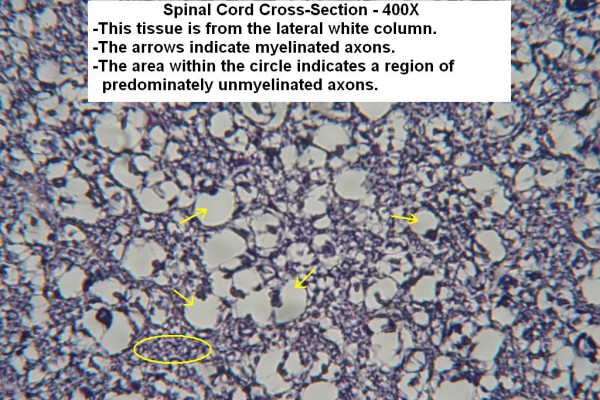 L – Spinal Cord X-Section – White Matter 400X