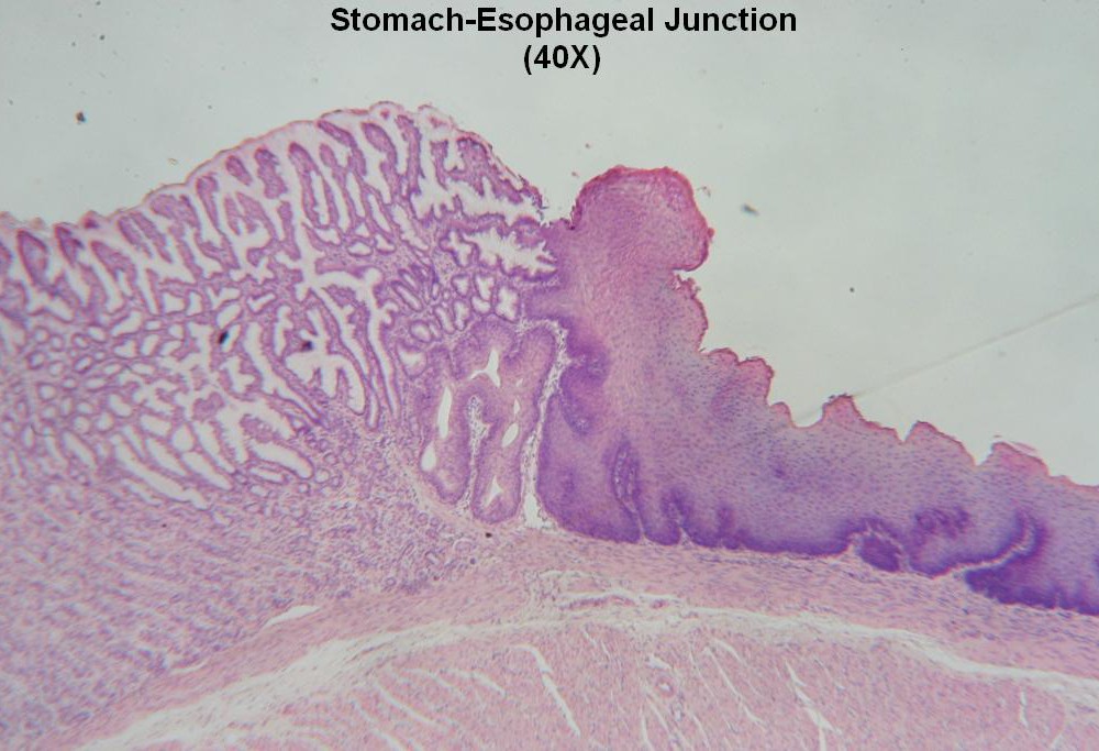 L Stomach- Esophagus Jxn 40X 2