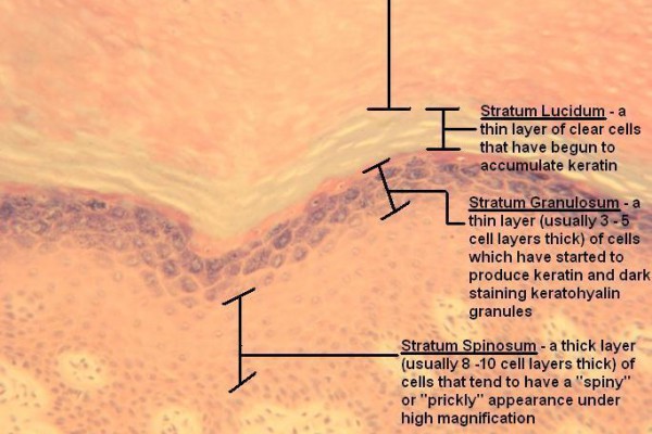 L – Thick Skin 100X 6 – Epidermal Layers