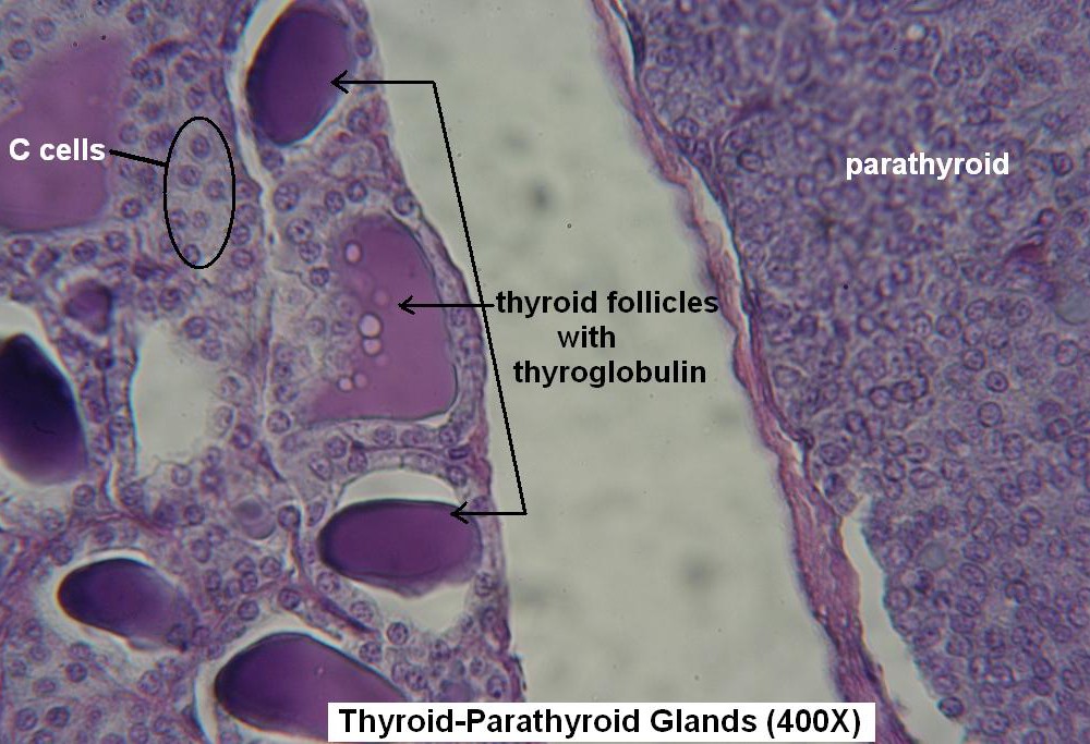 L-Thyroid- Parathyroid 400X 4