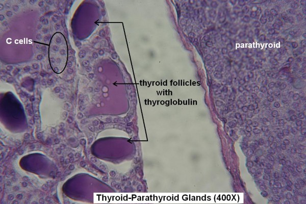 L-Thyroid- Parathyroid 400X 4
