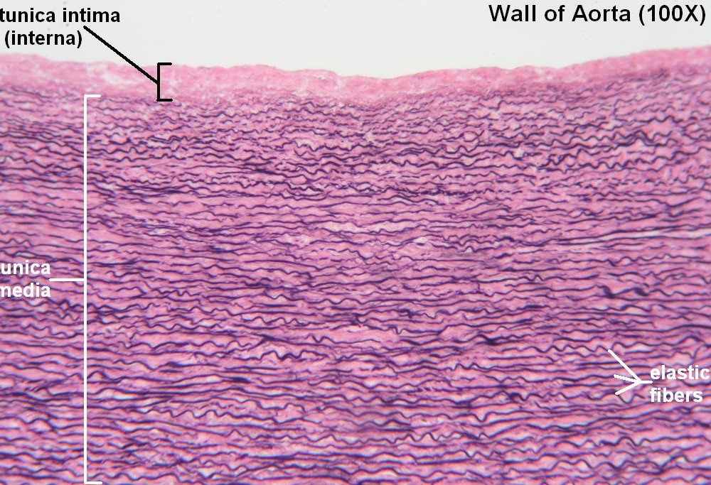L Wall of Aorta 100X 1