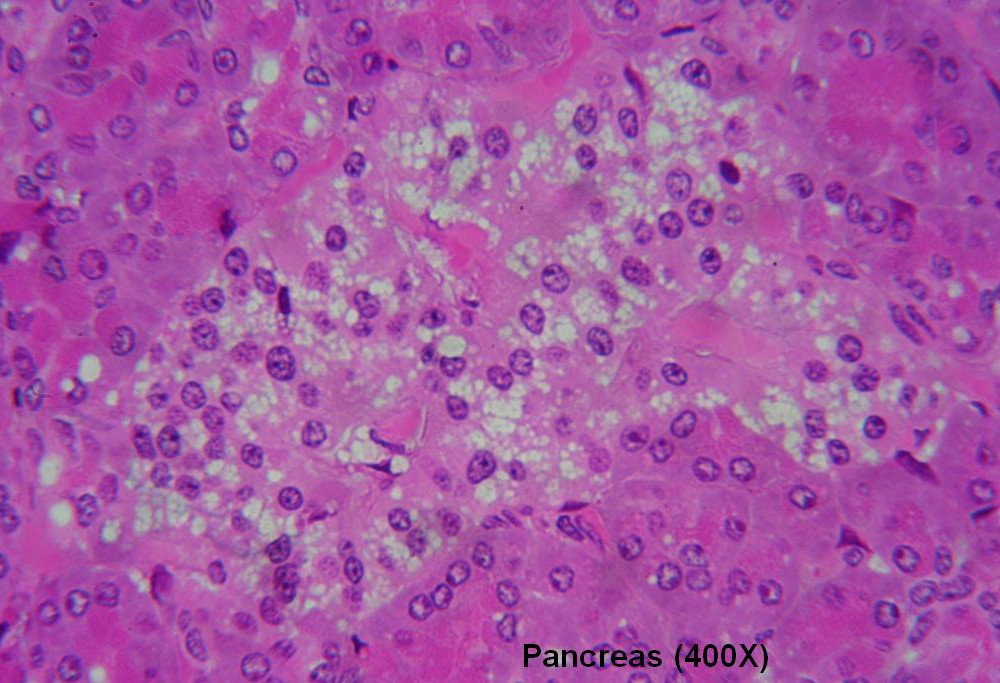 M – Pancreas 400X 5