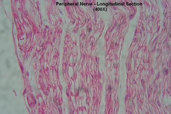 M – Peripheral Nerve – Long Section – Node of Ranvier 400X 2