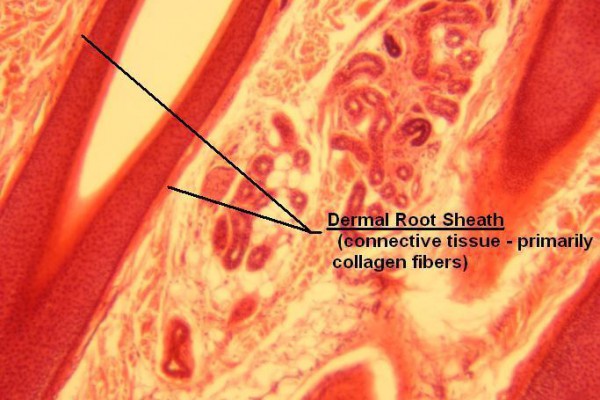 M Scalp 40x Root Sheath Regions