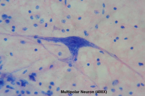 Multipolar Neuron 400X 2