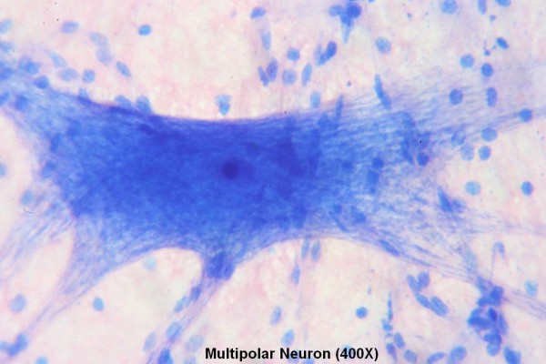 Multipolar Neuron 400X 3