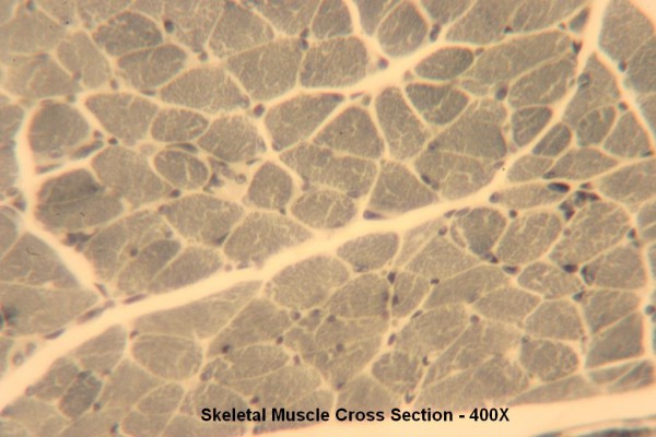 N Skeletal Muscle Section X Section 400x 3