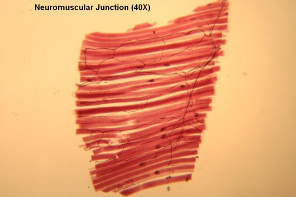 Neuromuscular Jxn 40X