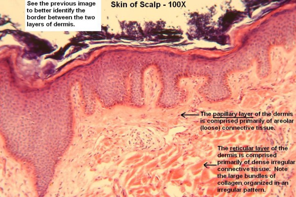 O  Scalp 100x 2 Layers of Dermis